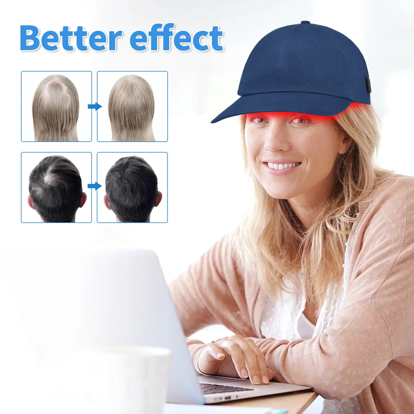 ScalpRevive/HairPulse Red Light Therapy Cap
